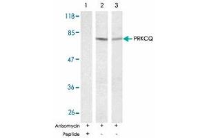 Western blot analysis of exreacts from HT-29 and K-562 cells untreated or treated with anisomycin (1mM, 30 min) using PRKCQ polyclonal antibody . (PKC theta Antikörper)