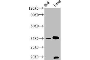 Western Blot Positive WB detected in: 293 whole cell lysate, Mouse lung tissue All lanes: CNN1 antibody at 1. (Rekombinanter CNN1 Antikörper)