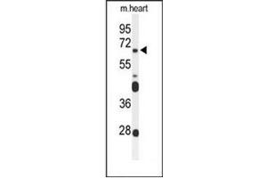 Western blot analysis of FZD4 Antibody (C-term) in mouse heart tissue lysates (35ug/lane). (FZD4 Antikörper  (C-Term))