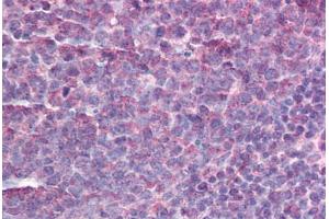 Human Tonsil (formalin-fixed, paraffin-embedded) stained with AICDA antibody ABIN214183 at 5 ug/ml followed by biotinylated goat anti-rabbit IgG secondary antibody ABIN481713, alkaline phosphatase-streptavidin and chromogen. (AICDA Antikörper  (C-Term))