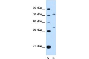 Western Blotting (WB) image for anti-Interleukin 28 Receptor, alpha (Interferon, lambda Receptor) (IL28RA) antibody (ABIN2463129) (IL28RA Antikörper)