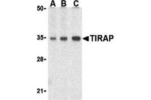 Western Blotting (WB) image for anti-Toll-Interleukin 1 Receptor (TIR) Domain Containing Adaptor Protein (TIRAP) (C-Term) antibody (ABIN1030739) (TIRAP Antikörper  (C-Term))
