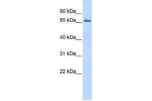 Human Placenta; WB Suggested Anti-ZNF503 Antibody Titration: 0. (ZNF503 Antikörper  (Middle Region))