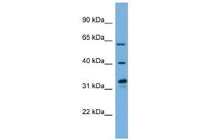 FMO3 antibody used at 1 ug/ml to detect target protein.