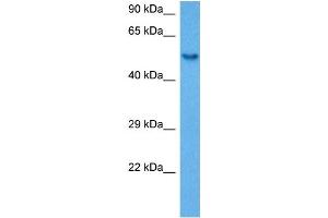 Host:  Rabbit  Target Name:  SP1  Sample Tissue:  Mouse Spleen  Antibody Dilution:  1ug/ml (SP1 Antikörper  (Middle Region))