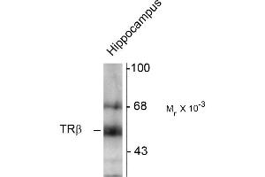 Western blots of hippocampal lysate showing specific immunolabeling of the ~58k TR-ß protein. (THRB Antikörper  (N-Term))