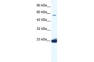 WB Suggested Anti-DDX55 Antibody Titration:  1. (DDX55 Antikörper  (C-Term))