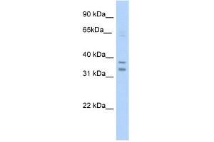 Western Blotting (WB) image for anti-Nuclear Receptor Subfamily 1, Group I, Member 3 (NR1I3) (C-Term) antibody (ABIN2779924)