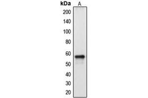 Western blot analysis of Cytochrome P450 2A13 expression in HepG2 (A) whole cell lysates. (CYP2A13 Antikörper  (Center))