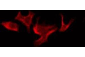 ABIN6276088 staining COLO205 by IF/ICC. (OR52B2 Antikörper  (Internal Region))