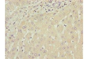 Immunohistochemistry of paraffin-embedded human liver tissue using ABIN7175794 at dilution of 1:100 (WDR74 Antikörper  (AA 111-366))