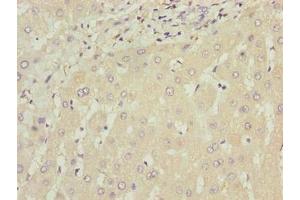 Immunohistochemistry of paraffin-embedded human liver tissue using ABIN7175794 at dilution of 1:100 (WDR74 Antikörper  (AA 111-366))
