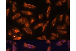 Immunofluorescence analysis of U-2 OS cells using CSF2 Polyclonal Antibody at dilution of 1:100. (GM-CSF Antikörper)
