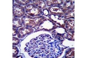 Immunohistochemistry (IHC) image for anti-Niemann-Pick Disease, Type C1 (NPC1) (AA 591-620) antibody (ABIN3031998)