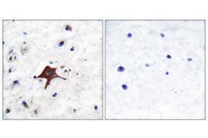 Immunohistochemistry (IHC) image for anti-Solute Carrier Family 2 (Facilitated Glucose Transporter), Member 3 (SLC2A3) (C-Term) antibody (ABIN1848584)