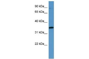 Western Blotting (WB) image for anti-Mitogen-Activated Protein Kinase-Activated Protein Kinase 3 (MAPKAPK3) (C-Term) antibody (ABIN2788403) (MAPKAP Kinase 3 Antikörper  (C-Term))