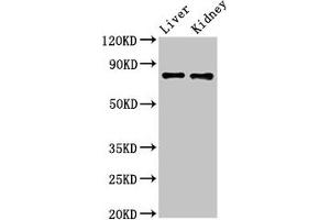 Western Blot Positive WB detected in: Mouse liver tissue, Mouse kidney tissue All lanes: SLC22A23 antibody at 5. (SLC22A23 Antikörper  (AA 3-206))