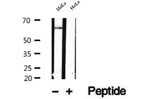 Western blot analysis of extracts of HeLa cells, using NFKBIZ antibody. (NFKBIZ Antikörper  (Internal Region))