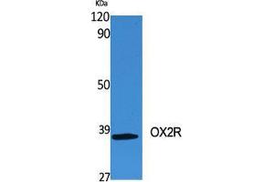 Western Blot (WB) analysis of specific cells using OX2R Polyclonal Antibody. (HCRTR2 Antikörper  (C-Term))