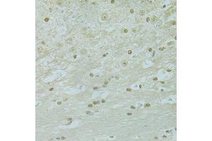 Immunohistochemistry of paraffin-embedded mouse brain using RCC1 antibody (ABIN5973761) at dilution of 1/100 (40x lens). (RCC1 Antikörper)