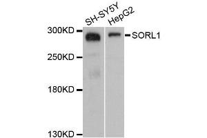 Western blot analysis of extracts of various cell lines, using SORL1 antibody. (SORL1 Antikörper  (AA 2065-2214))
