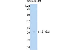 Western blot analysis of the recombinant protein. (IL12RB2 Antikörper  (AA 455-606))