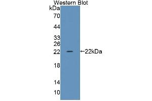 Western blot analysis of the recombinant protein. (TRERF1 Antikörper  (AA 785-942))