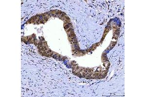 IHC analysis of SSRP1 using anti-SSRP1 antibody (ABIN7600496).