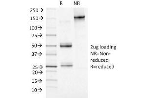 SDS-PAGE Analysis Purified Adipophilin Mouse Monoclonal Antibody (ADFP/1493). (ADRP Antikörper  (AA 249-376))