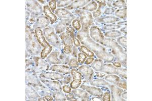 Immunohistochemistry of paraffin-embedded mouse kidney using DC Rabbit mAb (ABIN7266685) at dilution of 1:200 (40x lens). (DCAF7 Antikörper)