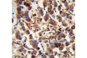 Immunohistochemistry (IHC) image for anti-Transcription Factor A, Mitochondrial (TFAM) (AA 216-246) antibody (ABIN3029196)