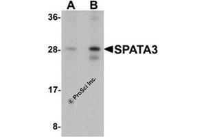 Western Blotting (WB) image for anti-Spermatogenesis Associated 3 (SPATA3) (C-Term) antibody (ABIN1077366) (SPATA3 Antikörper  (C-Term))