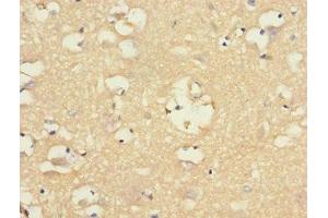 Immunohistochemistry (IHC) image for anti-Cholinergic Receptor, Nicotinic, alpha 9 (Neuronal) (CHRNA9) (AA 26-240) antibody (ABIN7161350)