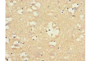 Immunohistochemistry of paraffin-embedded human brain tissue using ABIN7161350 at dilution of 1:100
