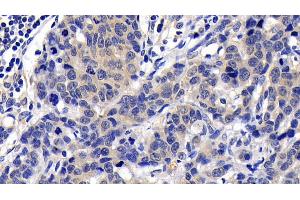 Immunohistochemistry (IHC) image for anti-Caspase 8 (CASP8) (AA 385-479) antibody (ABIN7437074)