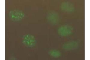 Immunofluorescence (IF) image for anti-Chromatin Assembly Factor 1, Subunit B (p60) (CHAF1B) antibody (ABIN1105633) (CHAF1B Antikörper)