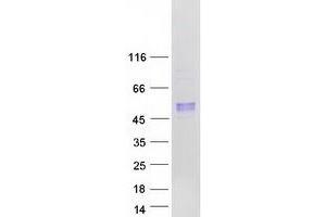 Validation with Western Blot (Arylsulfatase B Protein (ARSB) (Transcript Variant 2) (Myc-DYKDDDDK Tag))