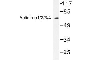 Image no. 1 for anti-alpha-Actinin Skeletal Muscle (ACTN) antibody (ABIN272285) (alpha Actinin Antikörper)