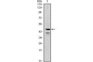 Western blot analysis using GATA1 mouse mAb against K562 (1) cell lysate. (GATA1 Antikörper)