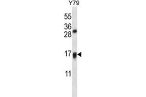 Western Blotting (WB) image for anti-Vitamin K Epoxide Reductase Complex, Subunit 1-Like 1 (VKORC1L1) antibody (ABIN2997461)