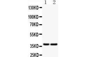 Western Blotting (WB) image for anti-B-cell antigen receptor complex-associated protein alpha chain (CD79A) (AA 121-226) antibody (ABIN3043397) (CD79a Antikörper  (AA 121-226))