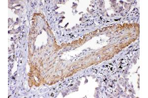Immunohistochemistry (IHC) image for anti-VEGF Receptor 2 (VEGFR2) (AA 20-242) antibody (ABIN5519021)
