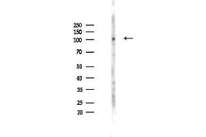 anti-OTU Domain Containing 7B (OTUD7B) (C-Term) antibody