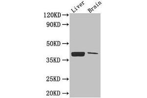 Western Blot Positive WB detected in: Mouse liver tissue, Mouse brain tissue All lanes: CXCR4 antibody at 2. (CXCR4 Antikörper  (AA 1-356))