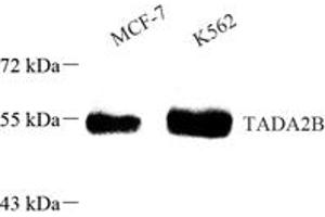 TADA2B Antikörper