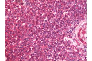 anti-DnaJ (Hsp40) Homolog, Subfamily A, Member 4 (DNAJA4) (AA 1-398) antibody