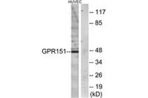 Western blot analysis of extracts from HuvEc cells, using GPR151 Antibody.
