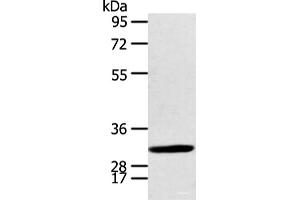 Western blot analysis of Human fetal brian tissue using CALB2 Polyclonal Antibody at dilution of 1:400 (Calretinin Antikörper)