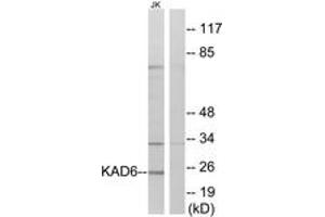 Western blot analysis of extracts from Jurkat cells, using KAD6 Antibody.