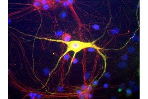 Rat mixed neuron/glial cultures stained with Peripherin antibody, (green channel) and the rabbit polyclonal antibody to the neurofilament subunit alpha-internexin (red). (Peripherin Antikörper)